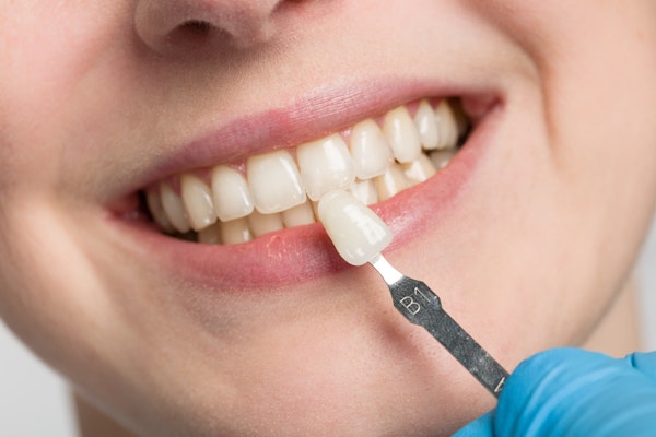Smiling patient with veneer being compared to other teeth