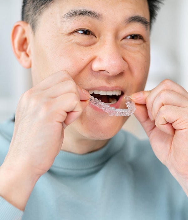 Man inserting clear aligner