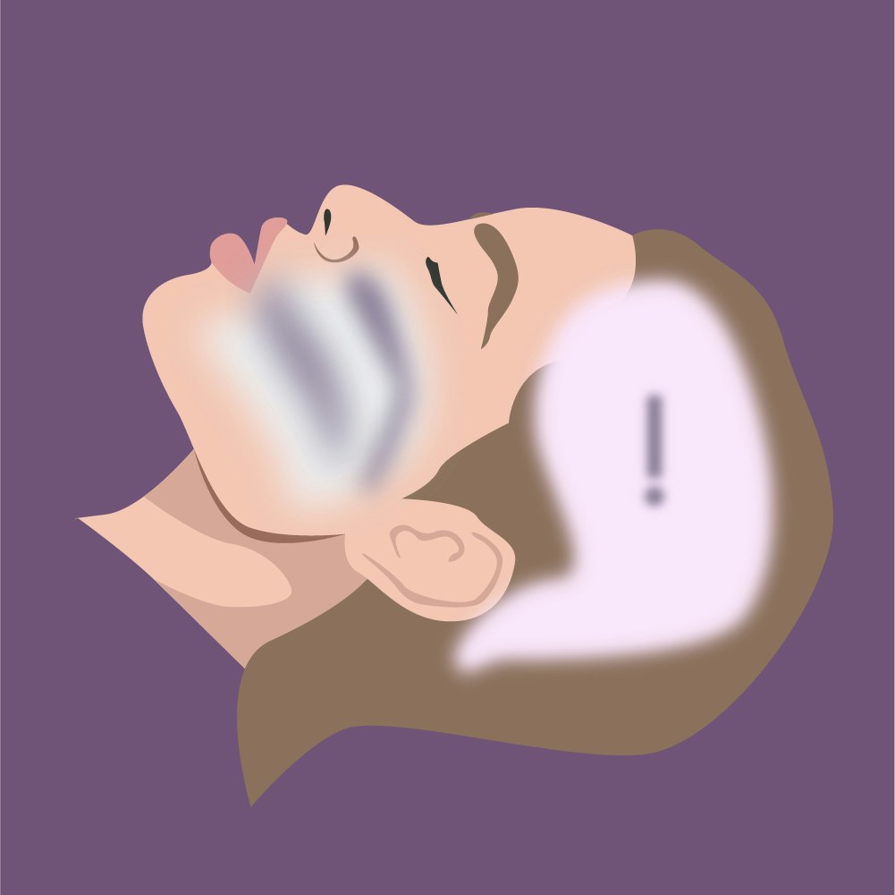 Complex sleep apnea