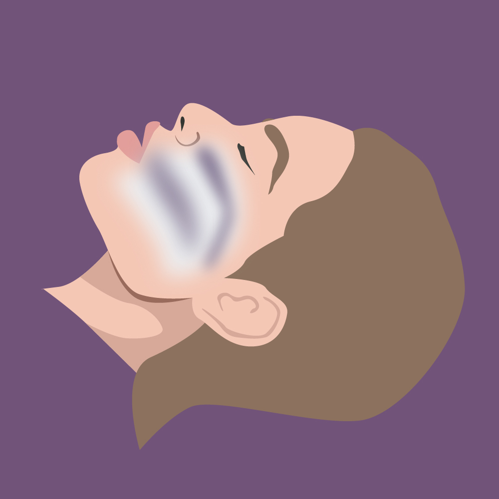 Obstructive sleep apnea