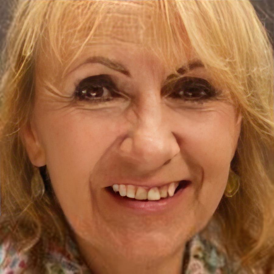 Before smile makeover