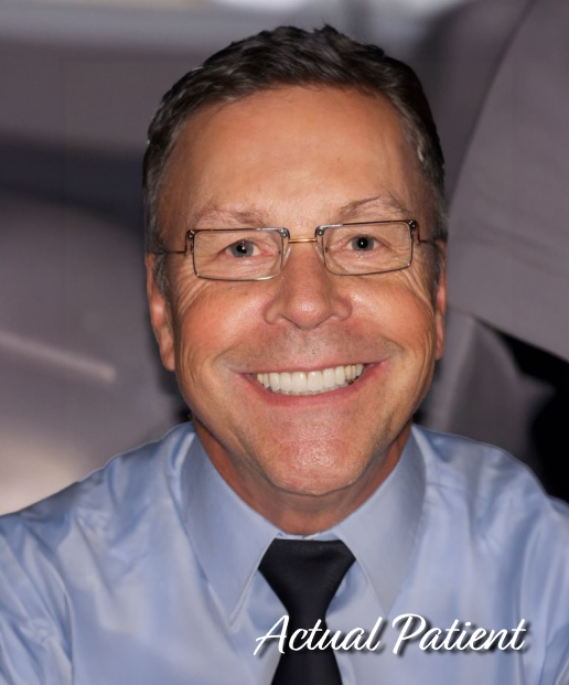 Rota Dental Real Patient After Results - Dave