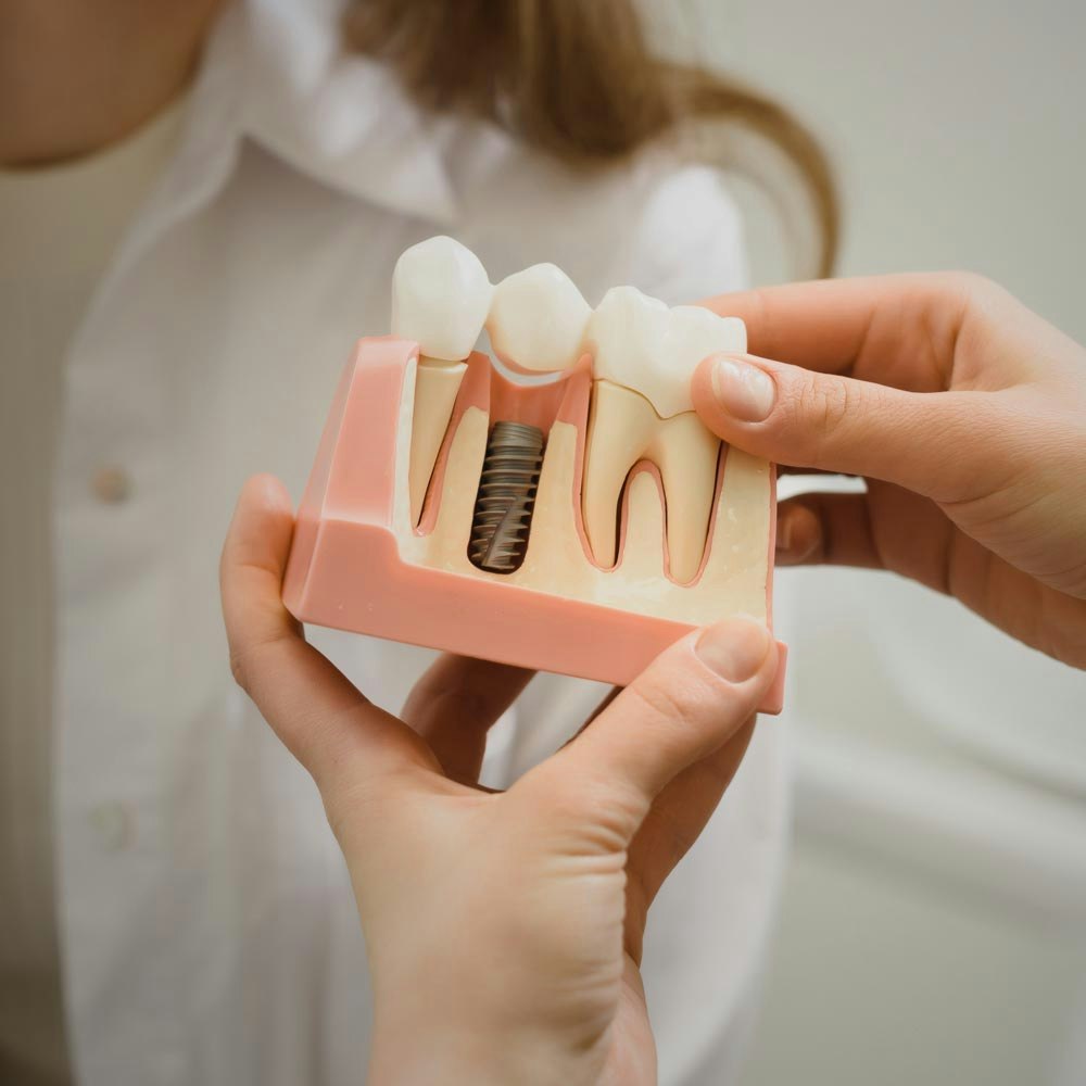 Model of jaw with dental implant