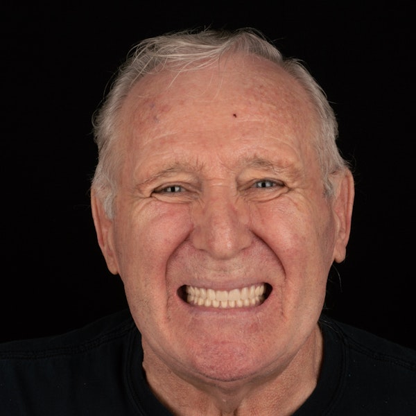 Smiling patient with a full set of teeth