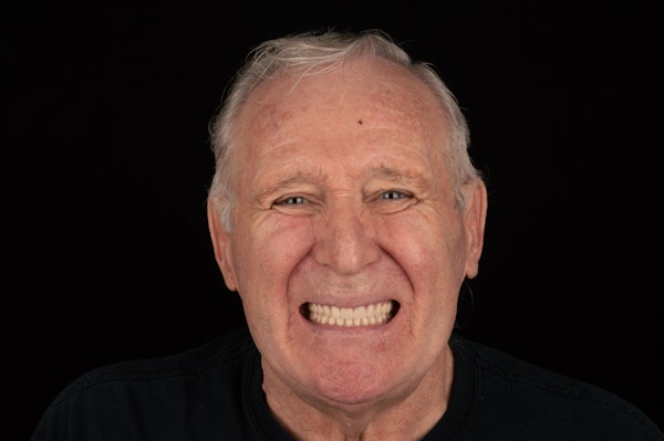 Smiling patient with a full set of teeth