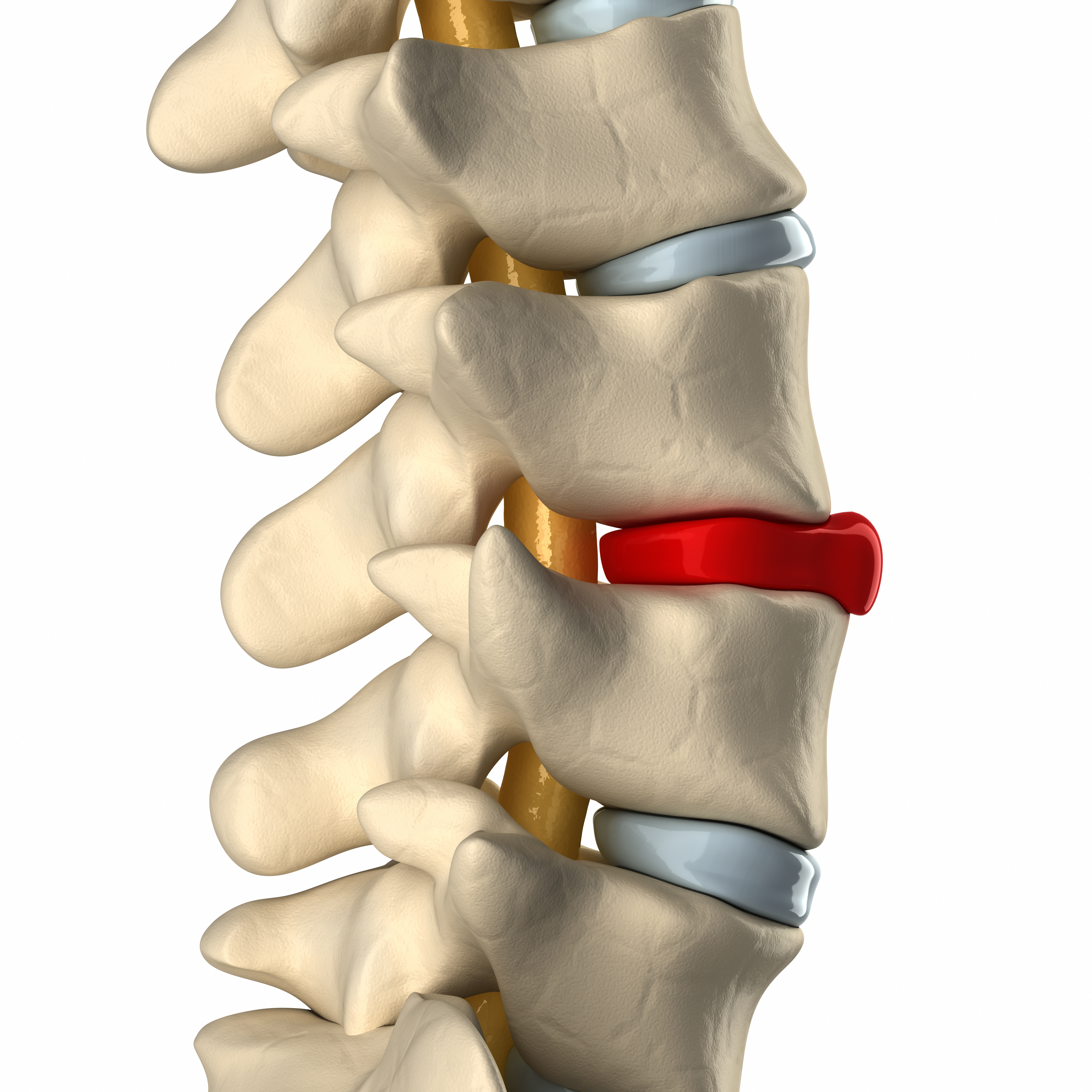 spinal model of arthritis