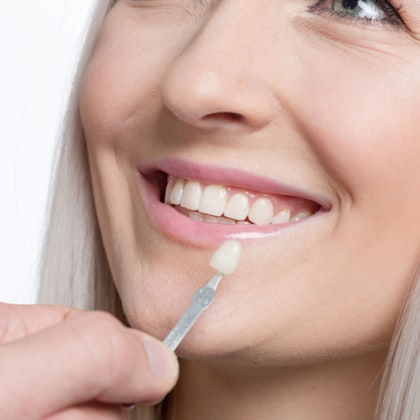 Dentist shade-matching veneers to a patients' smile