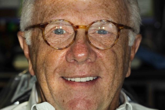 Dr. Mason Pirtle's patient after custom smile makeover