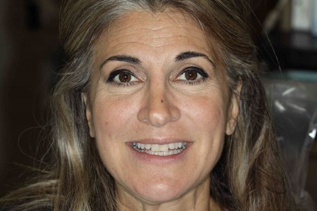 Dr. Mason Pirtle's patient before smile makeover