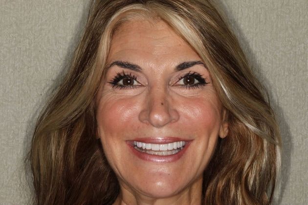 Dr. Mason Pirtle's patient after smile makeover