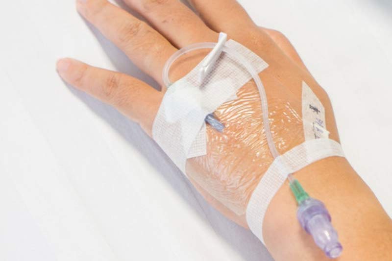 IV drip