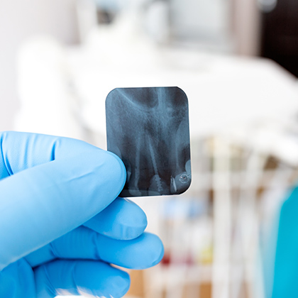 Gloved hand holding dental x-ray