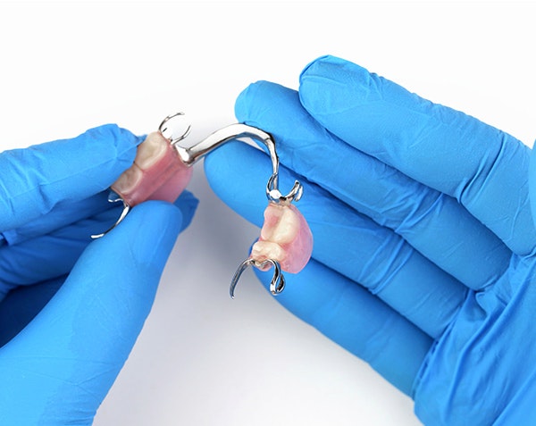 photo of partial dentures