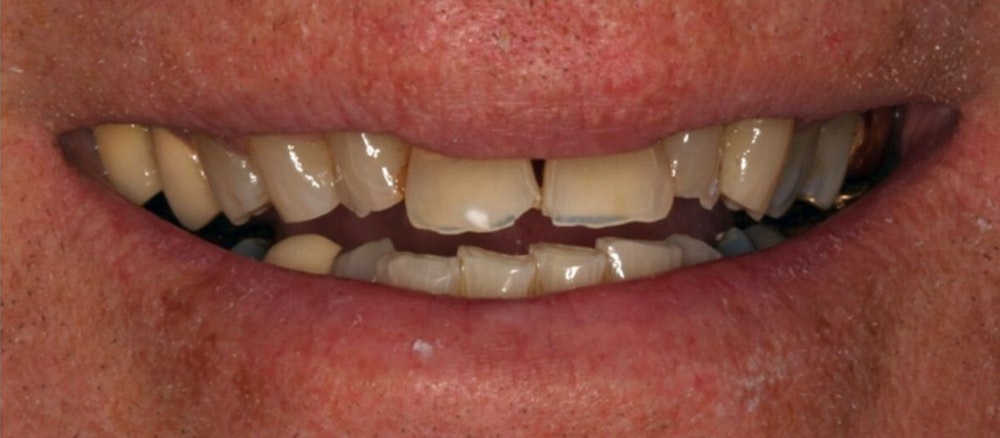 before smile makeover