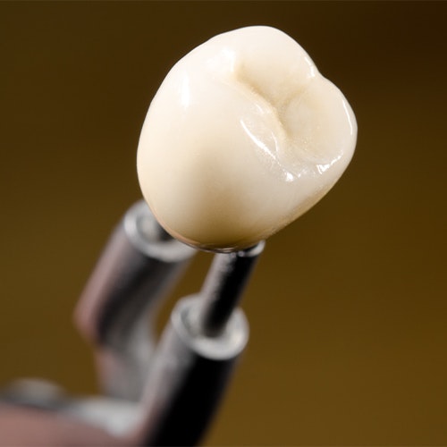 dental crowns