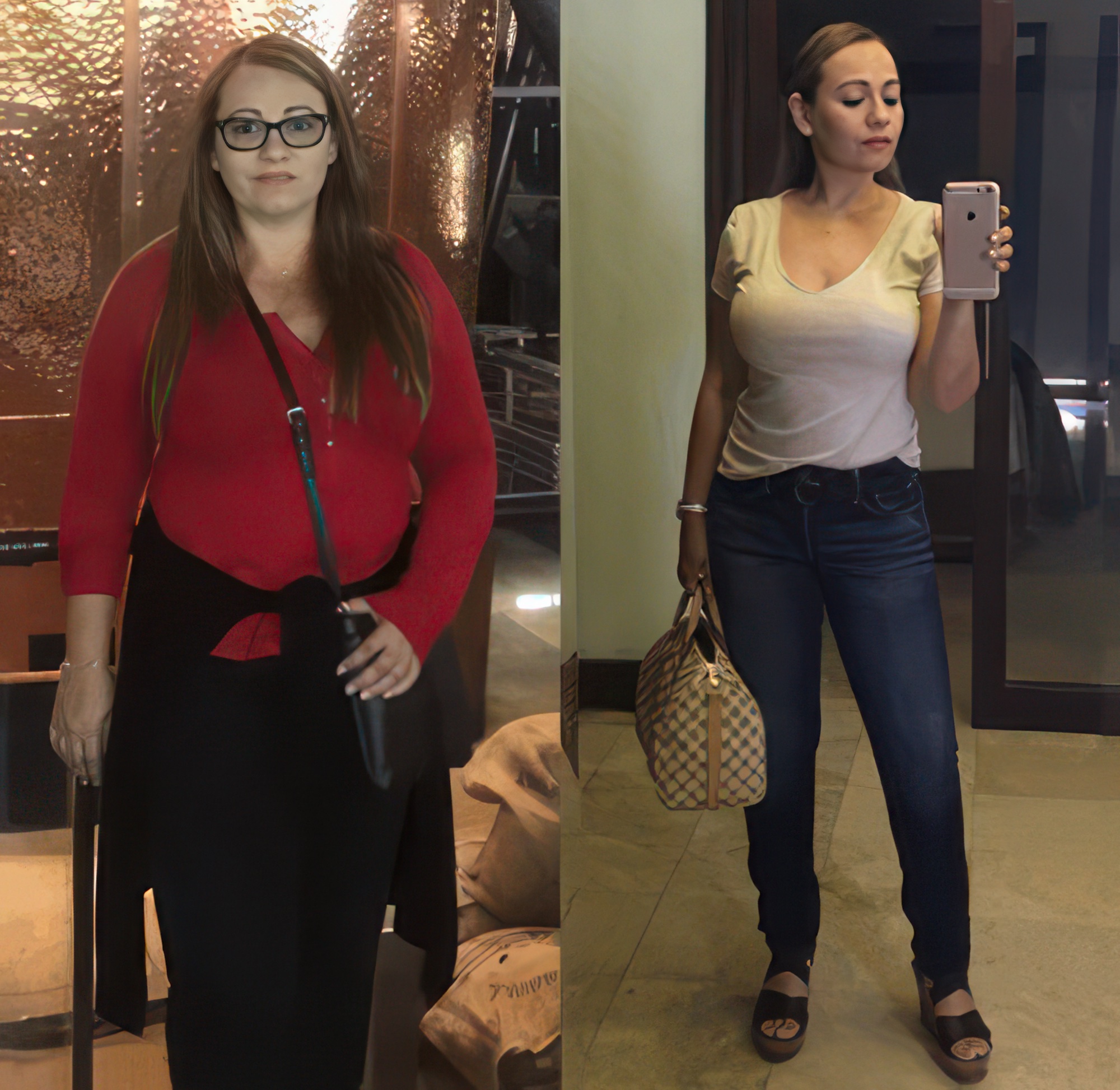 Bariatric & Weight Loss Recovery Garments