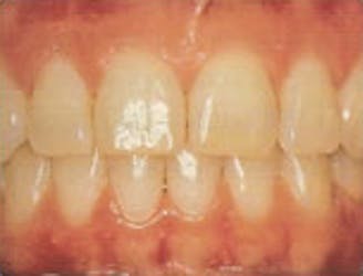 Healthy teeth and gums