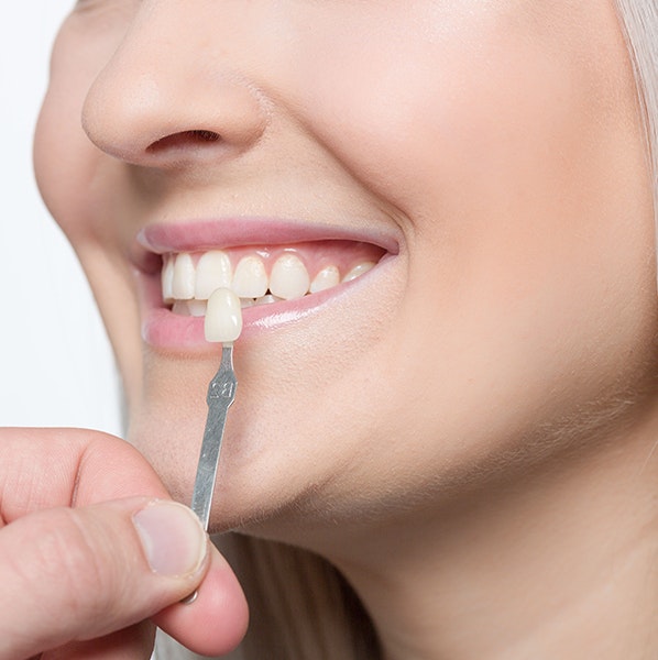 Dentist holding up a veneer to a patient's tooth