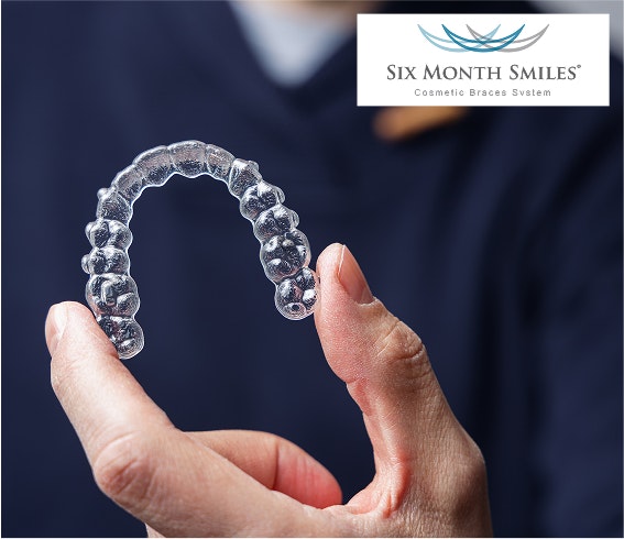 Six Month Smiles logo and man holding clear aligner