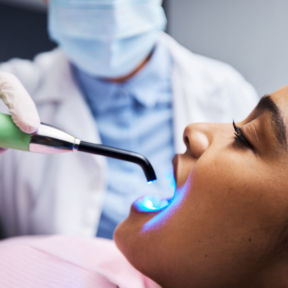 curing dental bonding