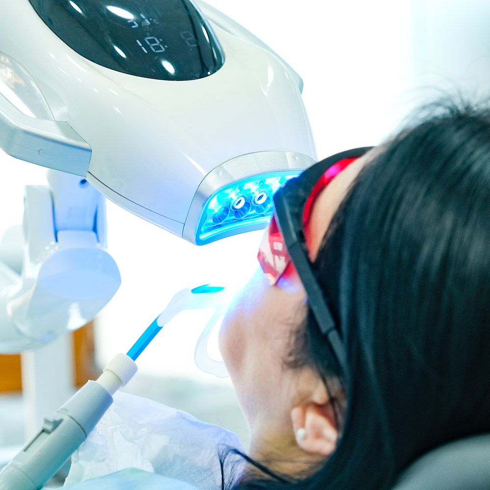 zoom whitening
