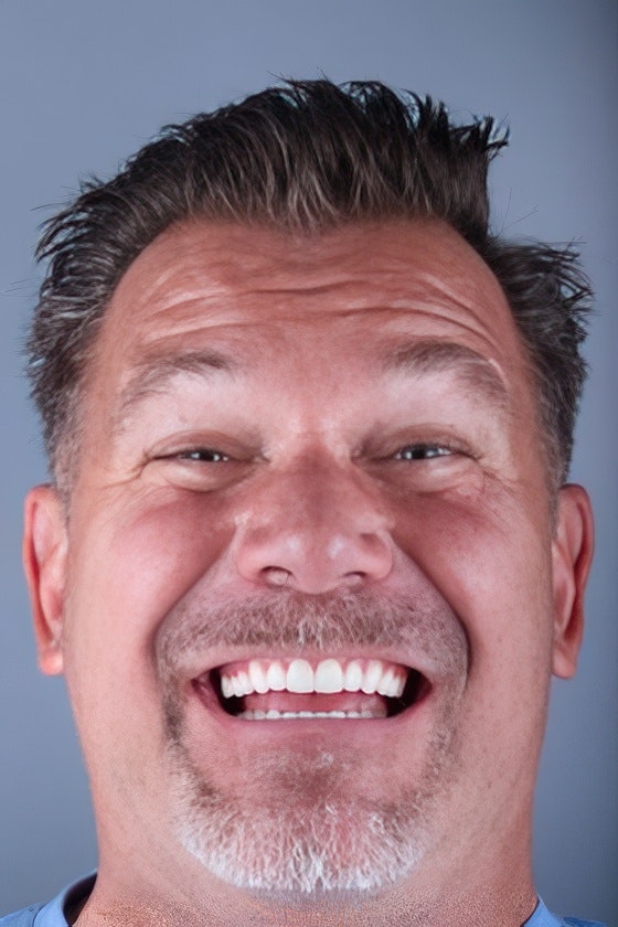 Loval Dental patient after dental crowns