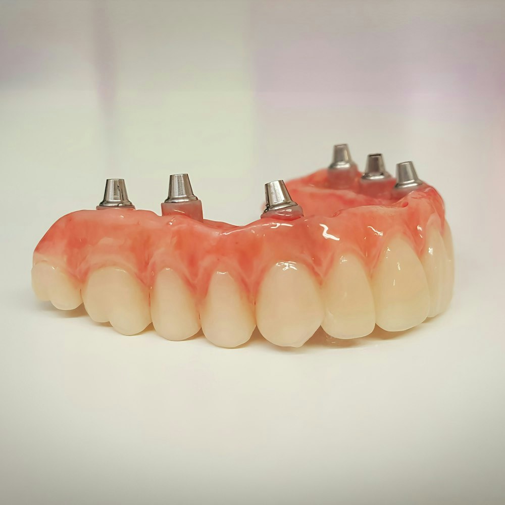 All-on-6 dentures