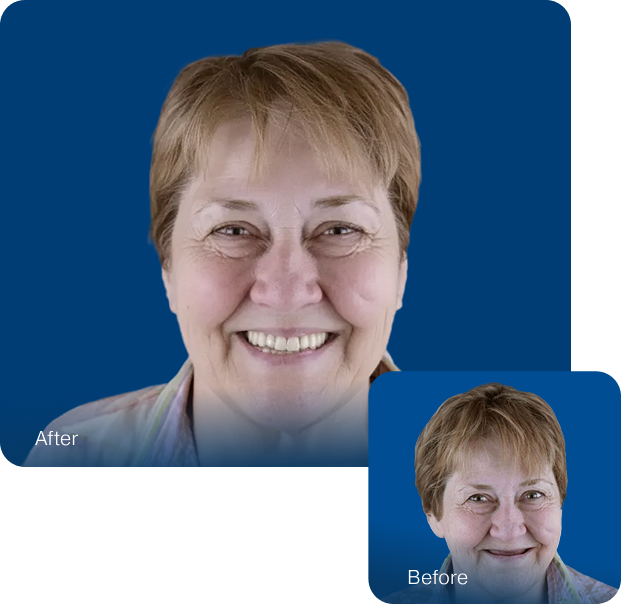 Patient before and after