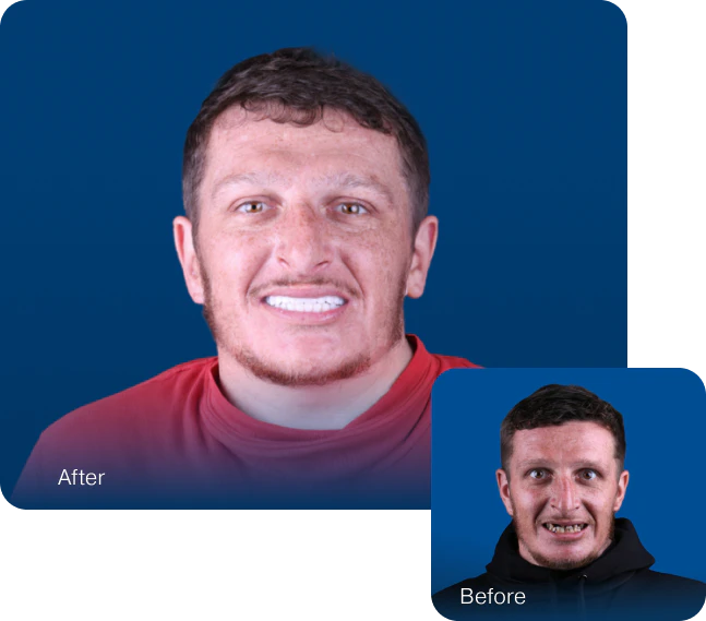 before and after treatment at LOVAL Dental