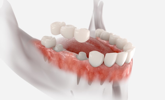 Traditional bridge illustration