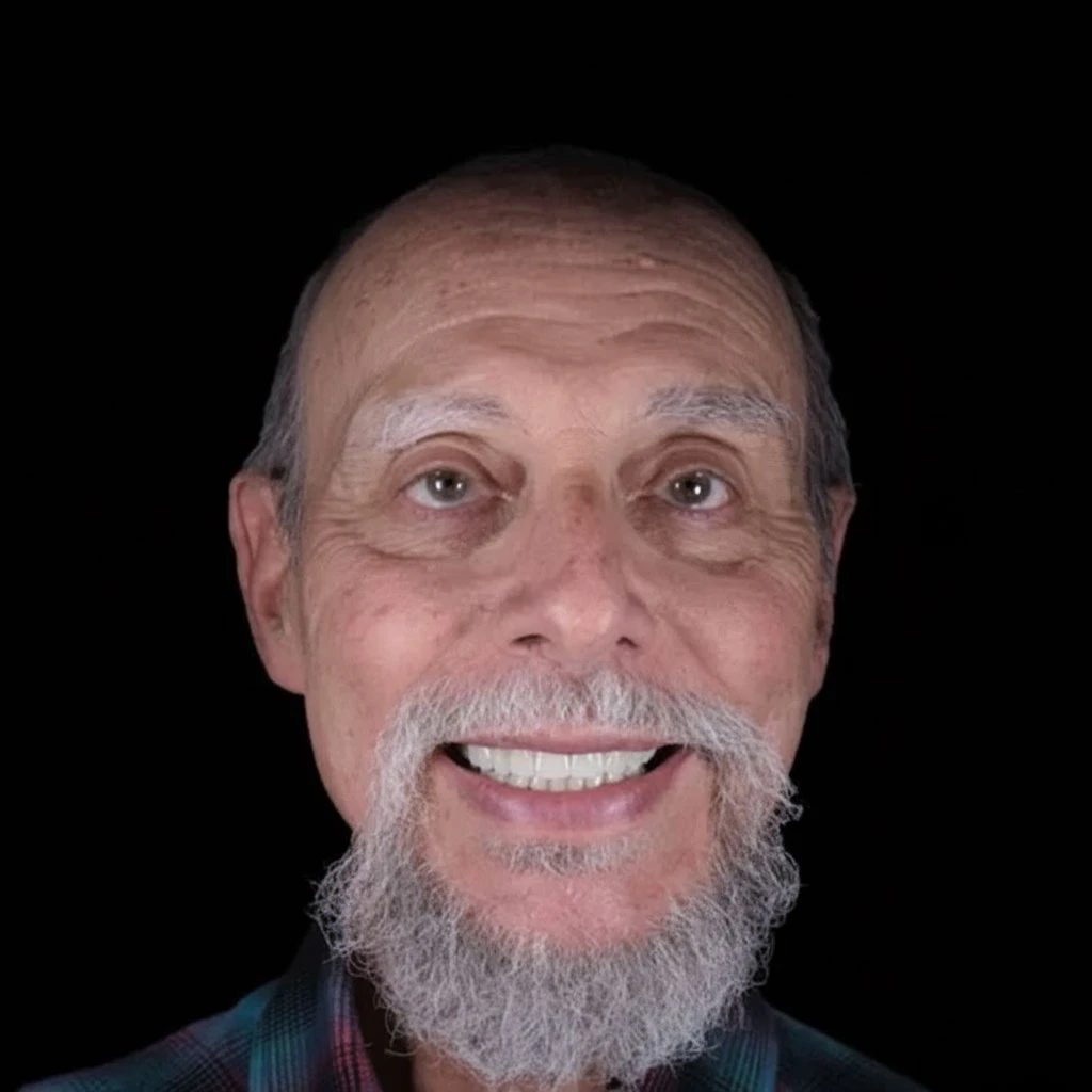 patient after full mouth reconstruction