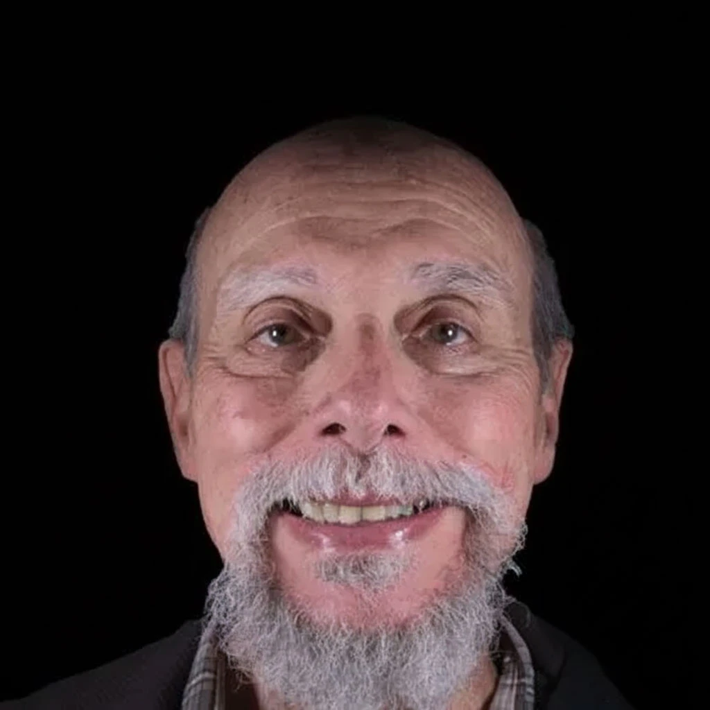 patient before full mouth reconstruction