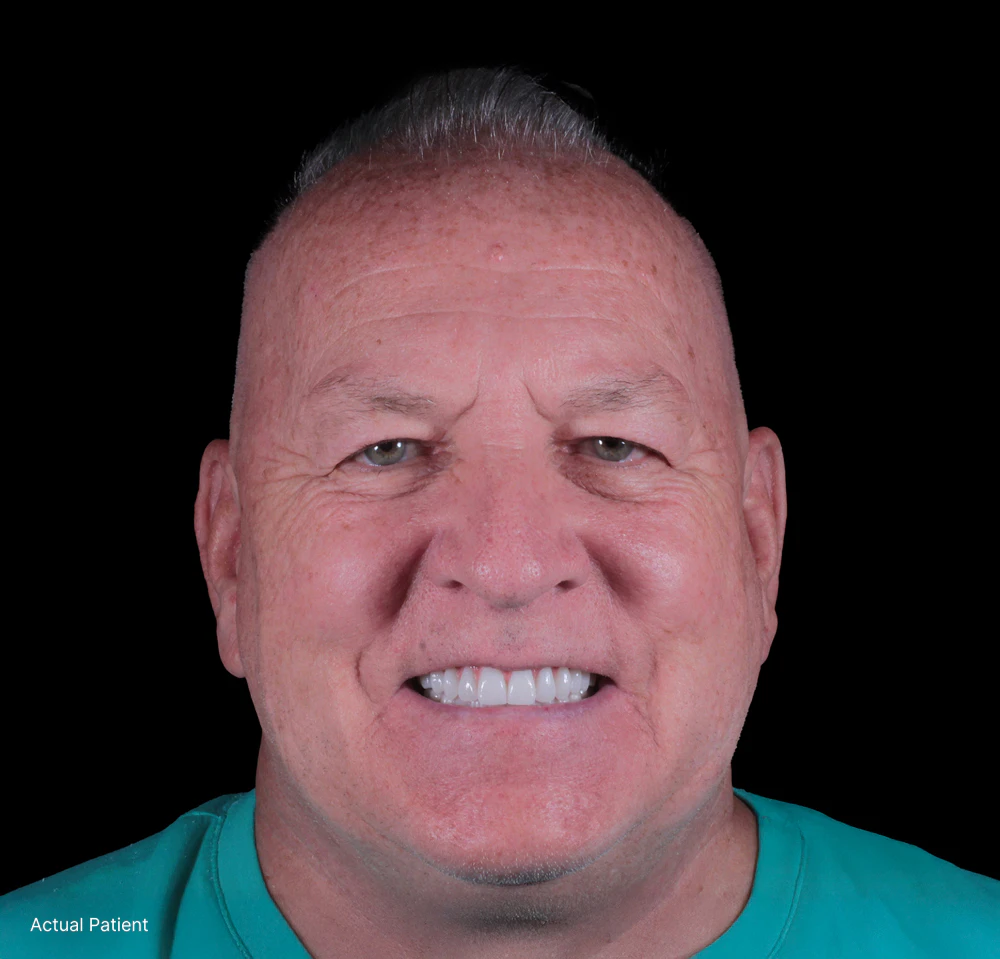 smiling dental implants patient