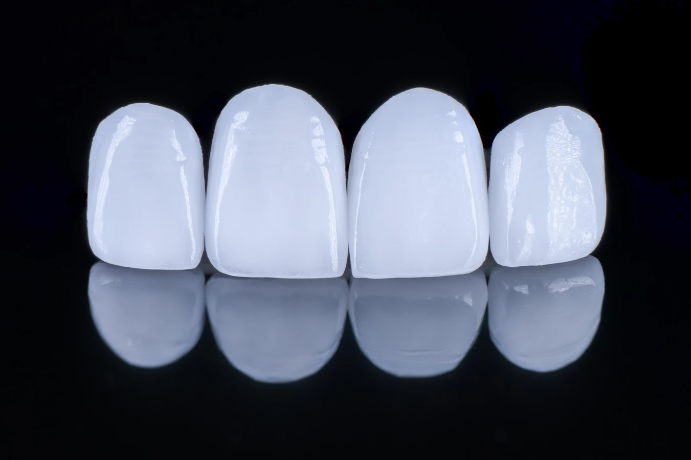 examples of pearly white veneers