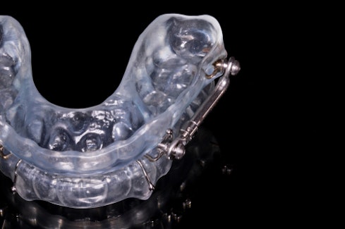 oral appliance for sleep apnea 