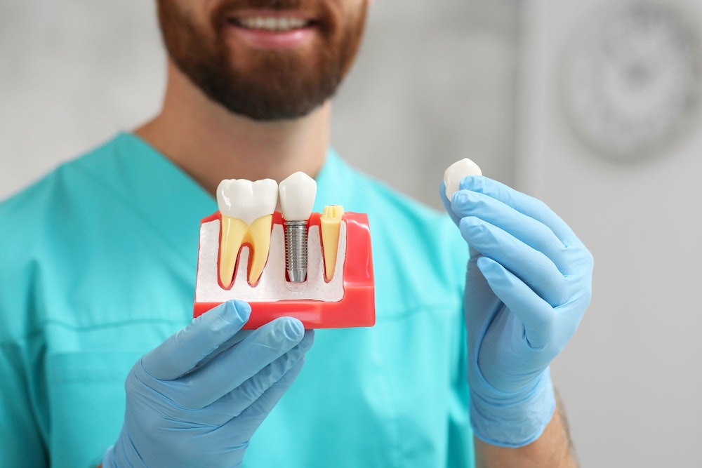 Smiling dental professional holding model of a dental implant