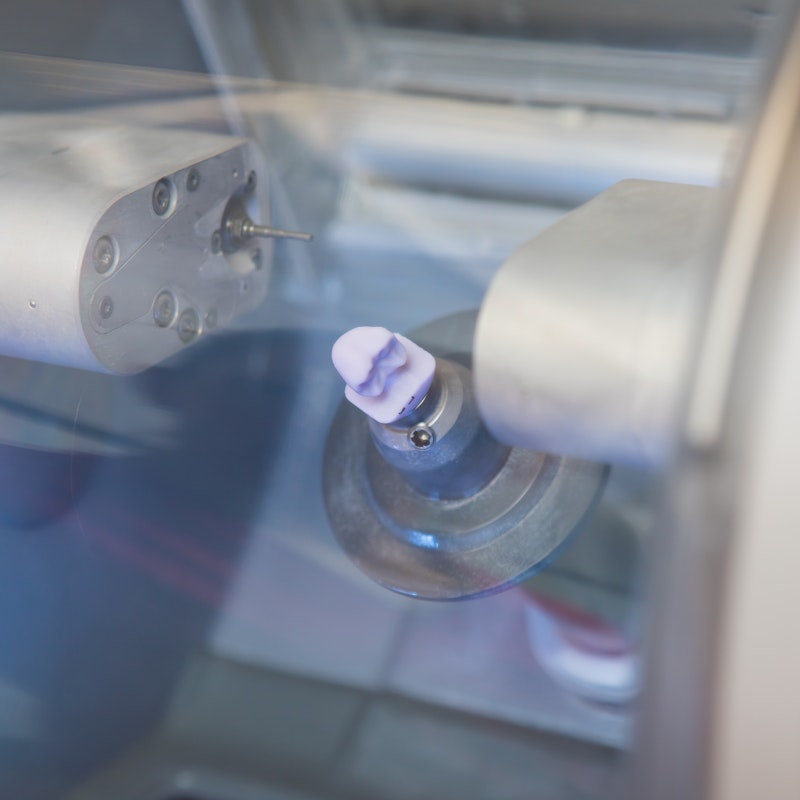 CAD/CAM technology milling a same-day crown