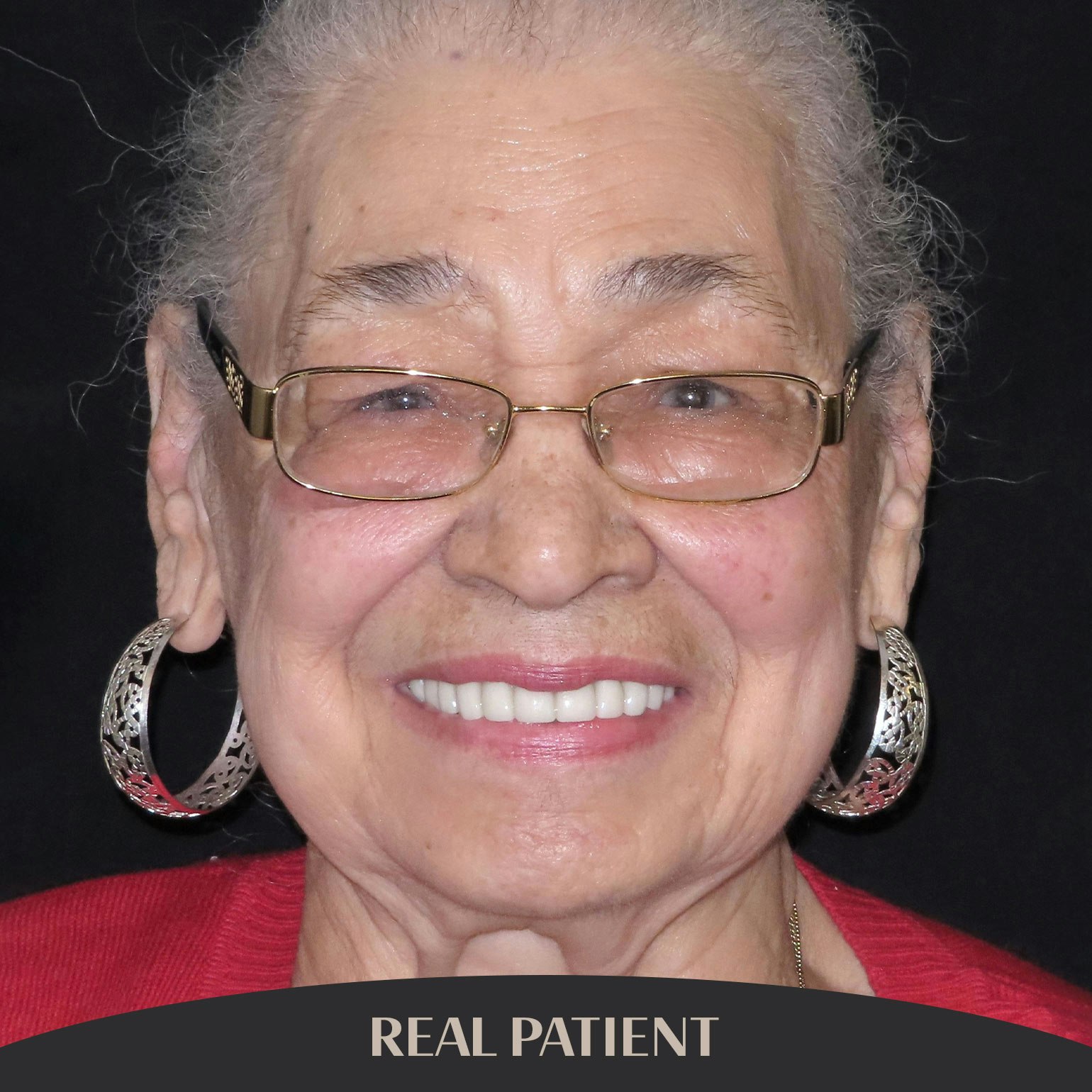 Grantonz, Real Patient