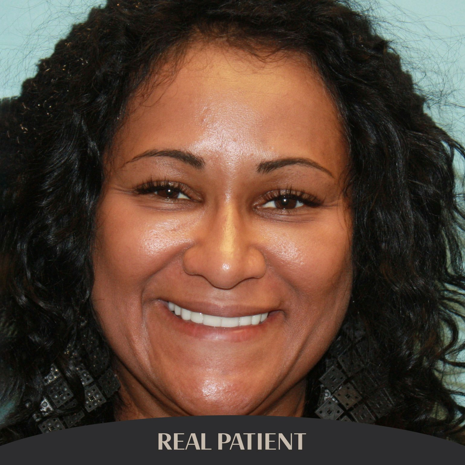 Nerissa, Real Patient