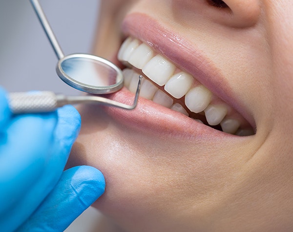 mouth with dental instruments