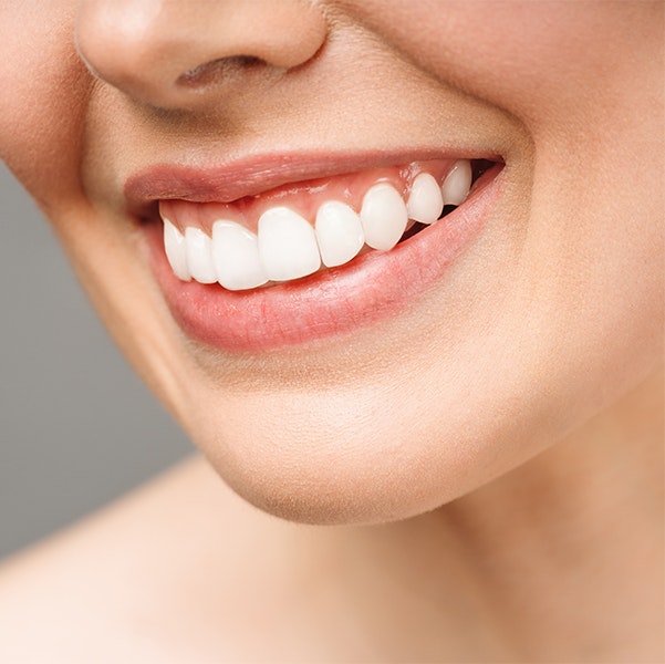 Close up of a pretty smile that could use crown lengthening