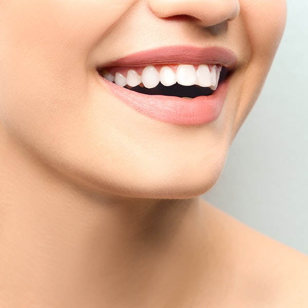 Are Gum Contouring Results Permanent? - Atlanta Smiles