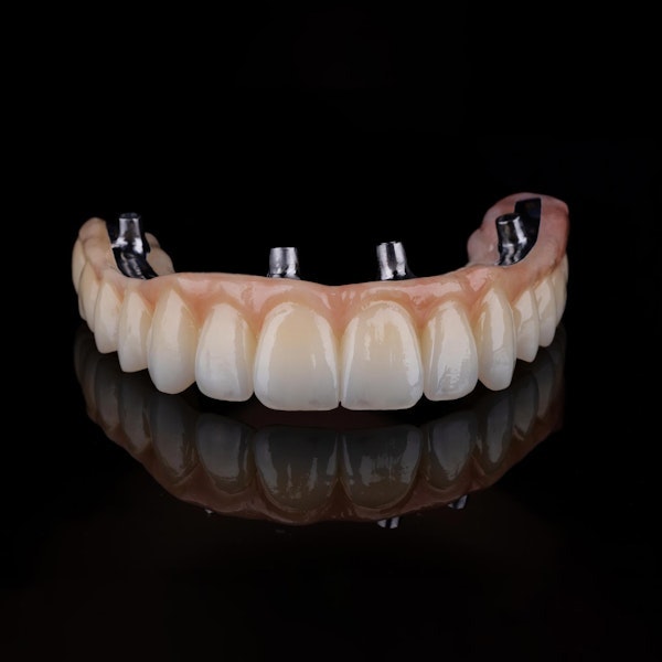 All-on-4 denture
