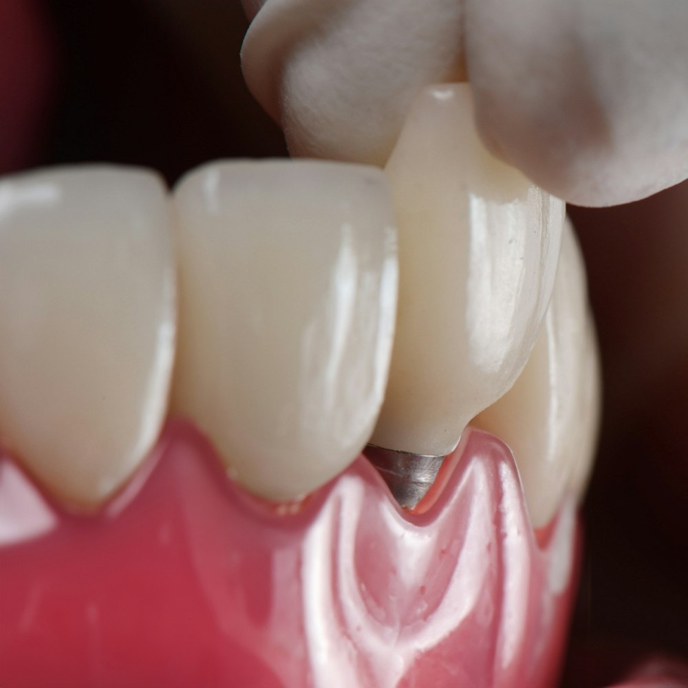 demonstration of implants