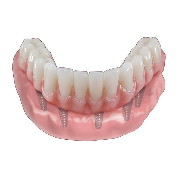 Hybrid Appliance Illustration