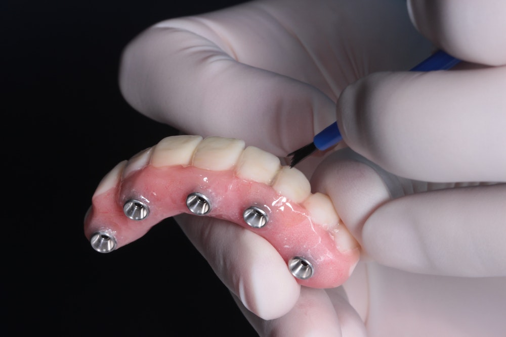Gloved hand holding implant dentures