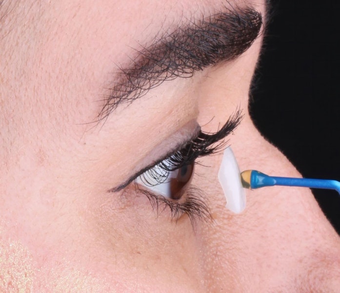 Veneers Los Algodones, MX Porcelain Veneers Supreme Dental Clinic