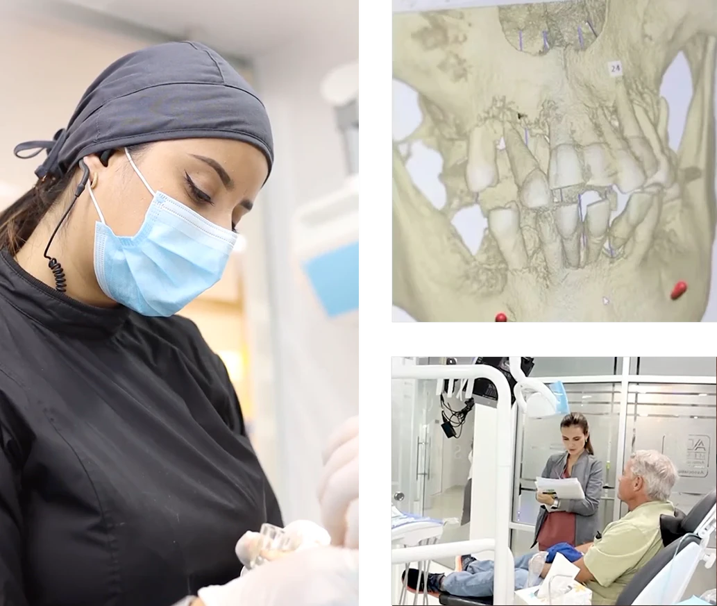 team working on dental bridges