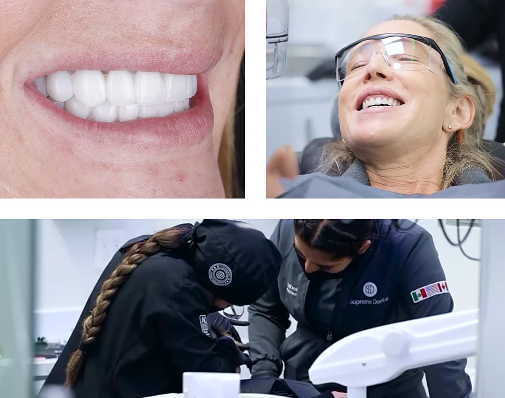 Patients getting dental implants