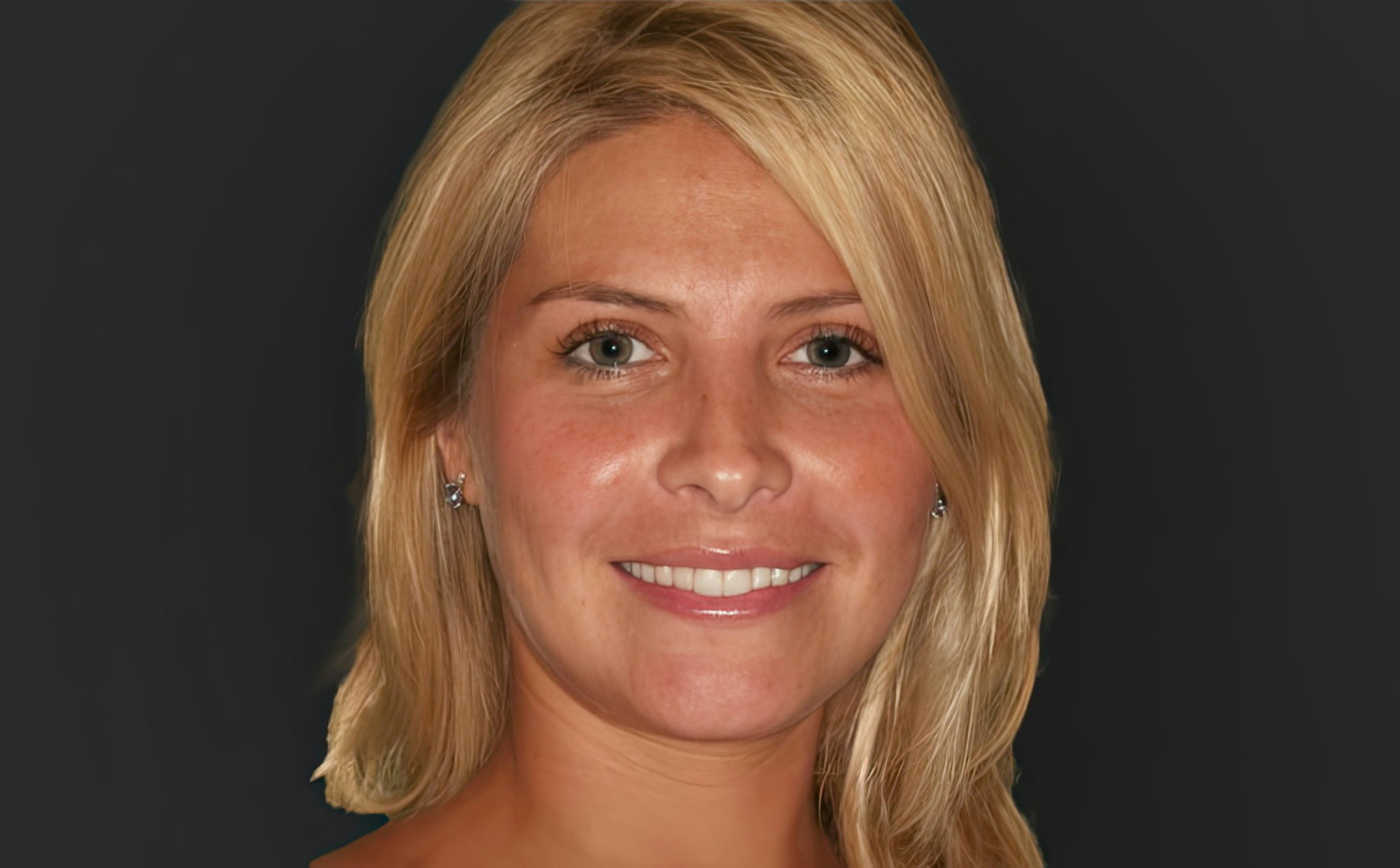 Patient with a repaired smile